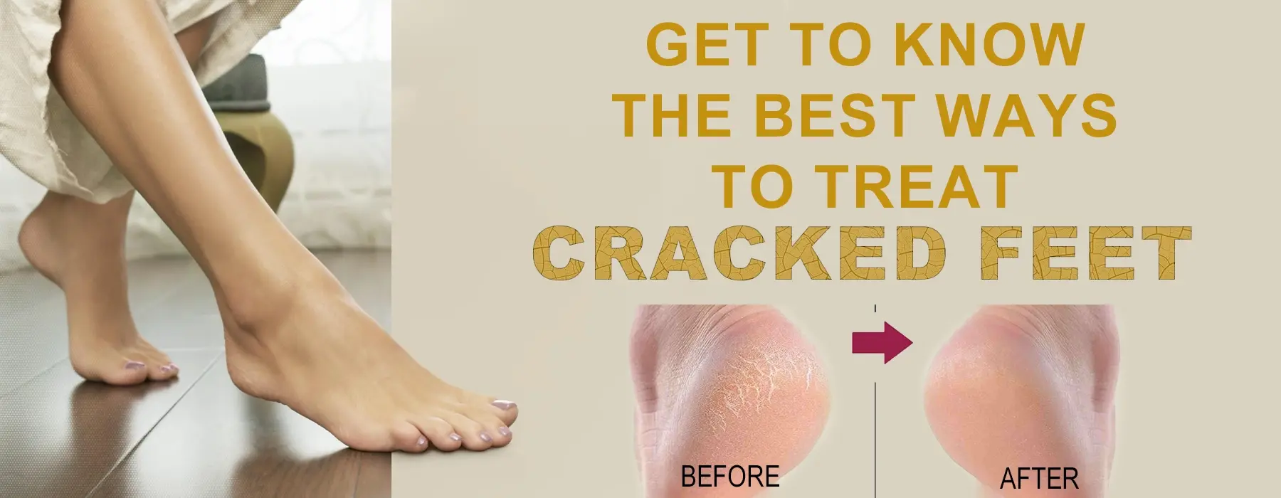 Best Ways To Treat Cracked Feet